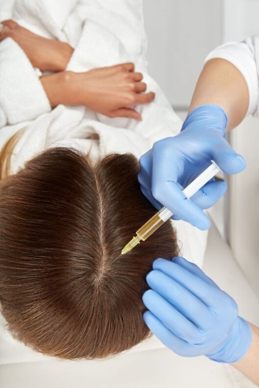 درمان ریزش مو با مزوتراپی موی سر