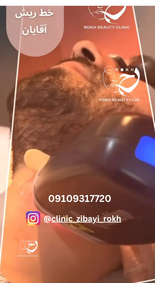 لیزر خط ریش و پشت گردن آقایان با بهترین دستگاه 